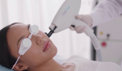 Smooth, Confident Skin Awaits – Expert Laser Hair Removal in Blackpool