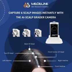Introducing the AI Scalp Grader – the future of scalp health assessments!