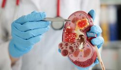 Best Nephrologists in Mumbai | Fortis Healthcare