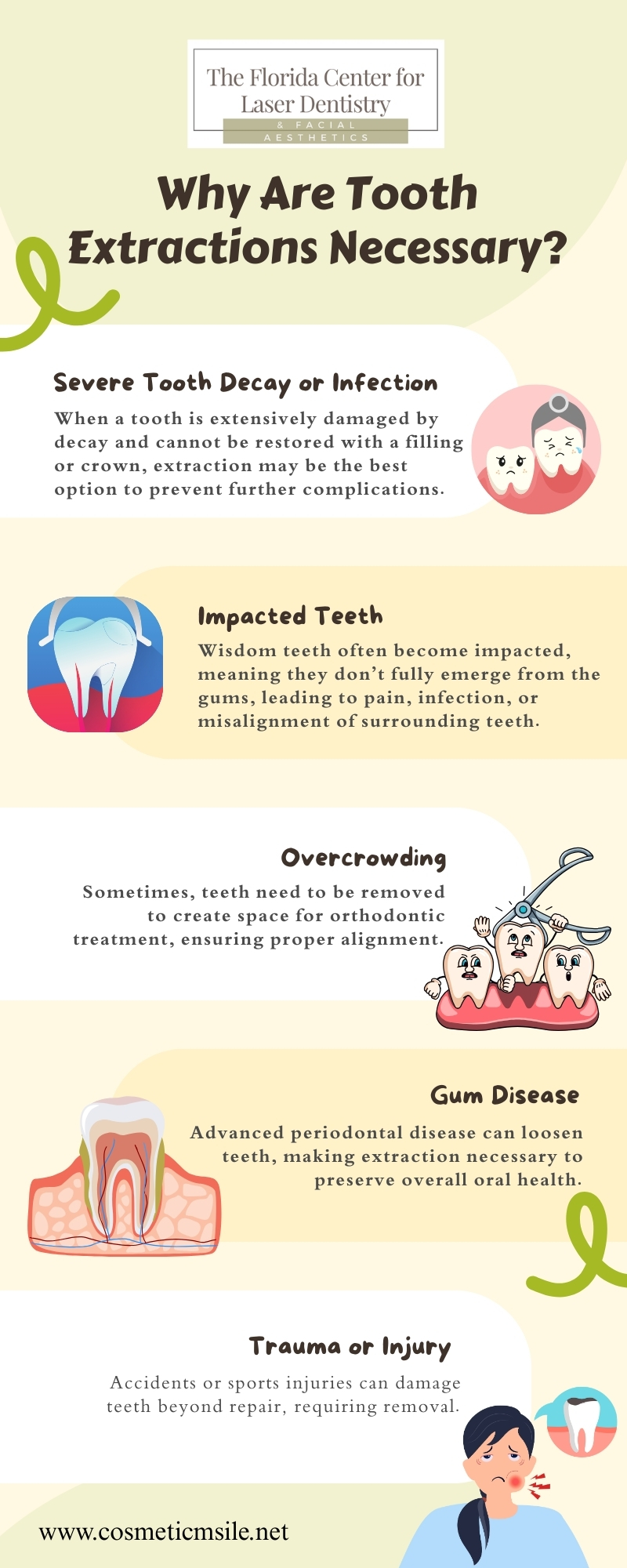 Tooth Extractions
