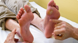Diabetic Wound Infection: Signs & When to Seek Medical Help