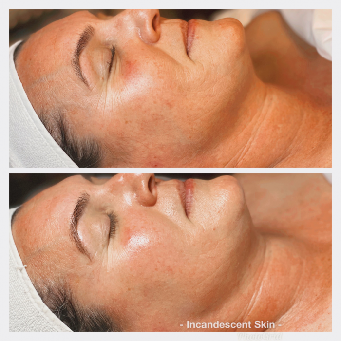 Tucson Healthy Skin