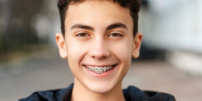 Invisible Braces in Andheri West | Discreet Orthodontics at Smile Couture Mumbai