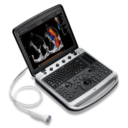 portable vascular ultrasound