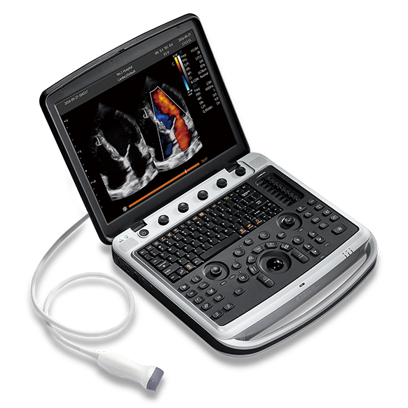 portable vascular ultrasound