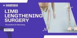 Limb Lengthening Surgery Cost in India | Affordable Height Growth Treatment | HOSPIDIO