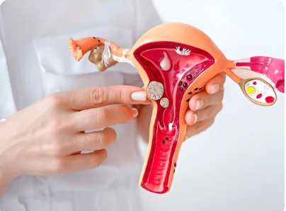 Why Ovarian Cancer Is Called the “Silent Killer”