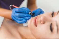 Skin Needling Course