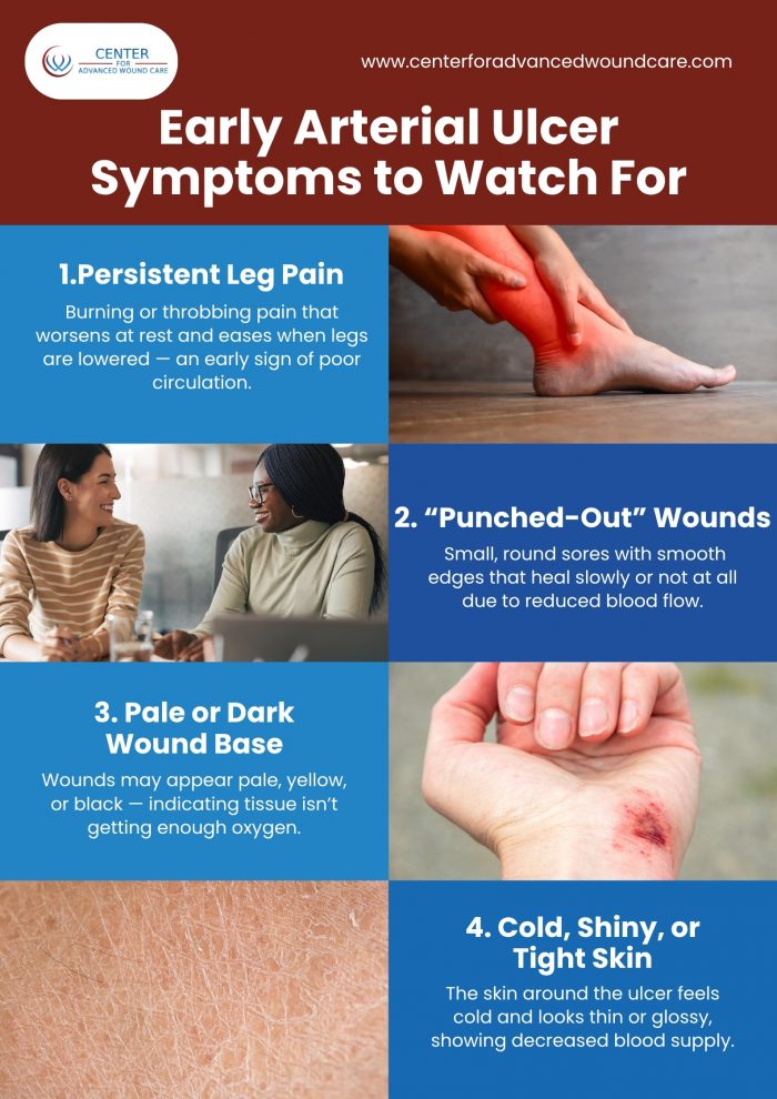 Early Arterial Ulcer Symptoms to Watch For