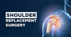 Best Shoulder Treatment in India: Advanced Orthopedic Care| HOSPIDIO