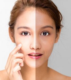A Complete Guide to Skin Brightening Treatment: Benefits, Risks, and Results