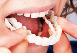 What Causes Gum Pigmentation and How Can Laser Treatment Help?