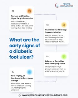 Early Signs of a Diabetic Foot Ulcer: What You Should Watch Out For