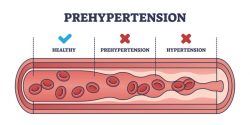 Hypertension Definition: Understanding High Blood Pressure and Its Impact on Health