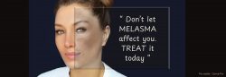 Brighten and Protect with BeboandCo Melasma Collection