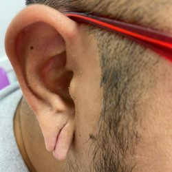 Express Care – Reliable Guam Clinic for Health & Skin Care