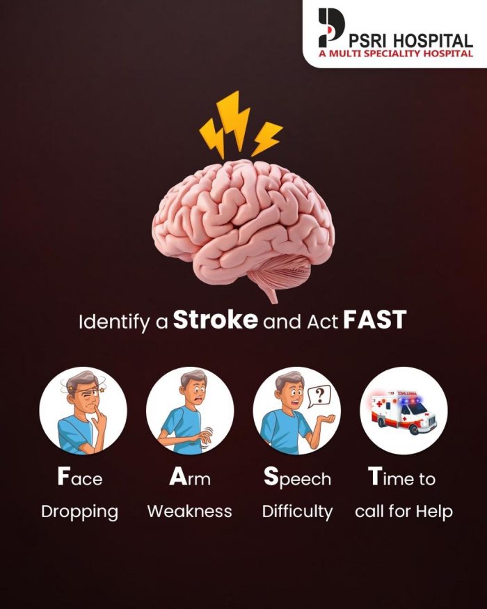 Act FAST – Spot the Signs of Stroke 🧠