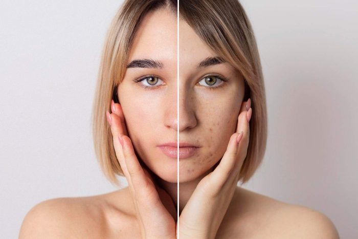 Repair and Protect Sun-Damaged Skin with BeboandCo