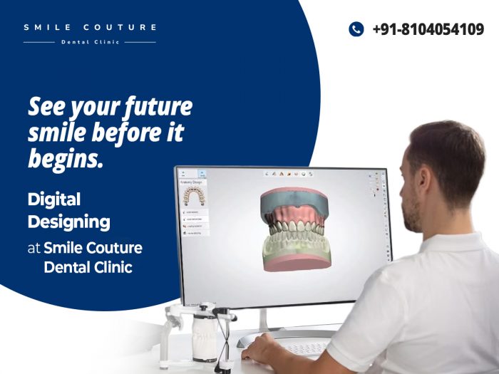 Digital Smile Designing | See Your Future Smile – Smile Couture Dental Clinic