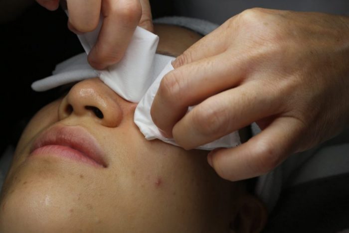 Facial with Extraction in Singapore by Mirage Aesthetic