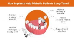 How Dental Implants Help Diabetic Patients Stay Healthy Long-Term
