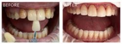 Dentist Castle Cove | Trusted Dental Care by Atria Dental Gordon