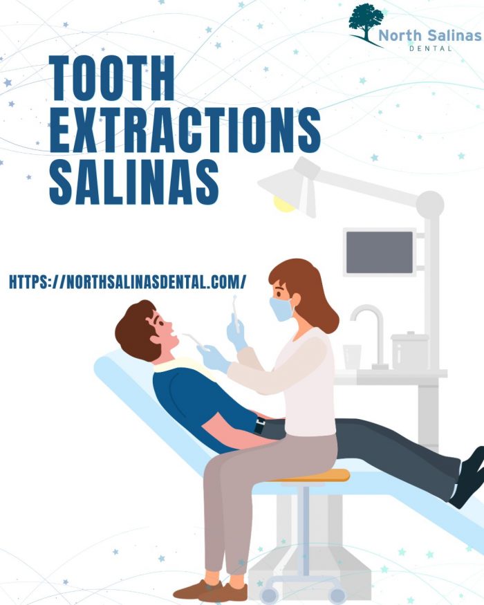 Safe Tooth Extractions Salinas Services For All Ages