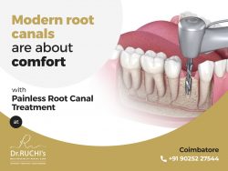 Painless Root Canal Treatment