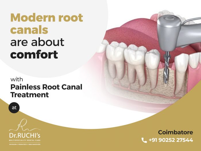 Painless Root Canal Treatment