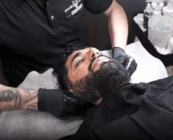 Laser Hair Removal for Men Sydney – A Real Overview