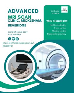 MRI scan Beveridge