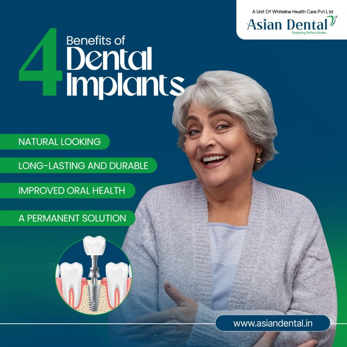 Restore Missing Teeth with Advanced Dental Implant Care