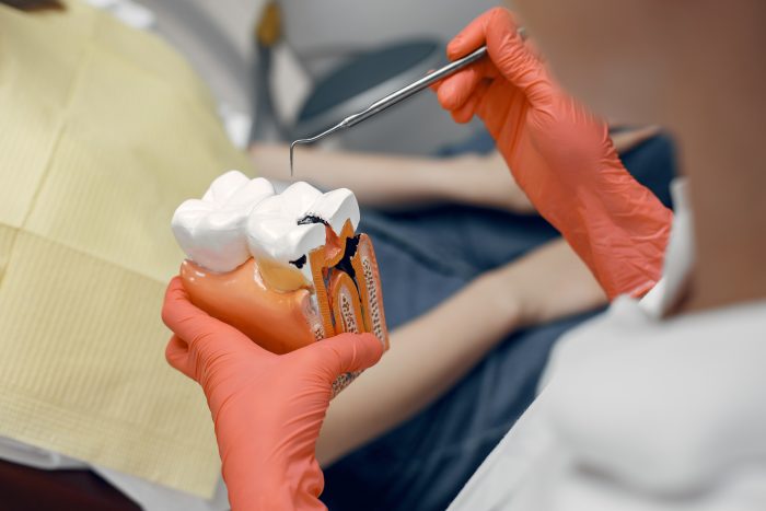 Gentle & Advanced Root Canal Treatment in Woodbridge, VA