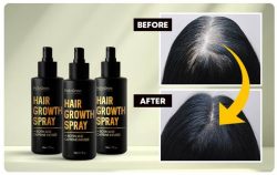 Omad Hair Spray Review✓⛔ [OFFICIAL PRICE AND BUY]-How Long Does Hair Growth Spray Take to Show R ...