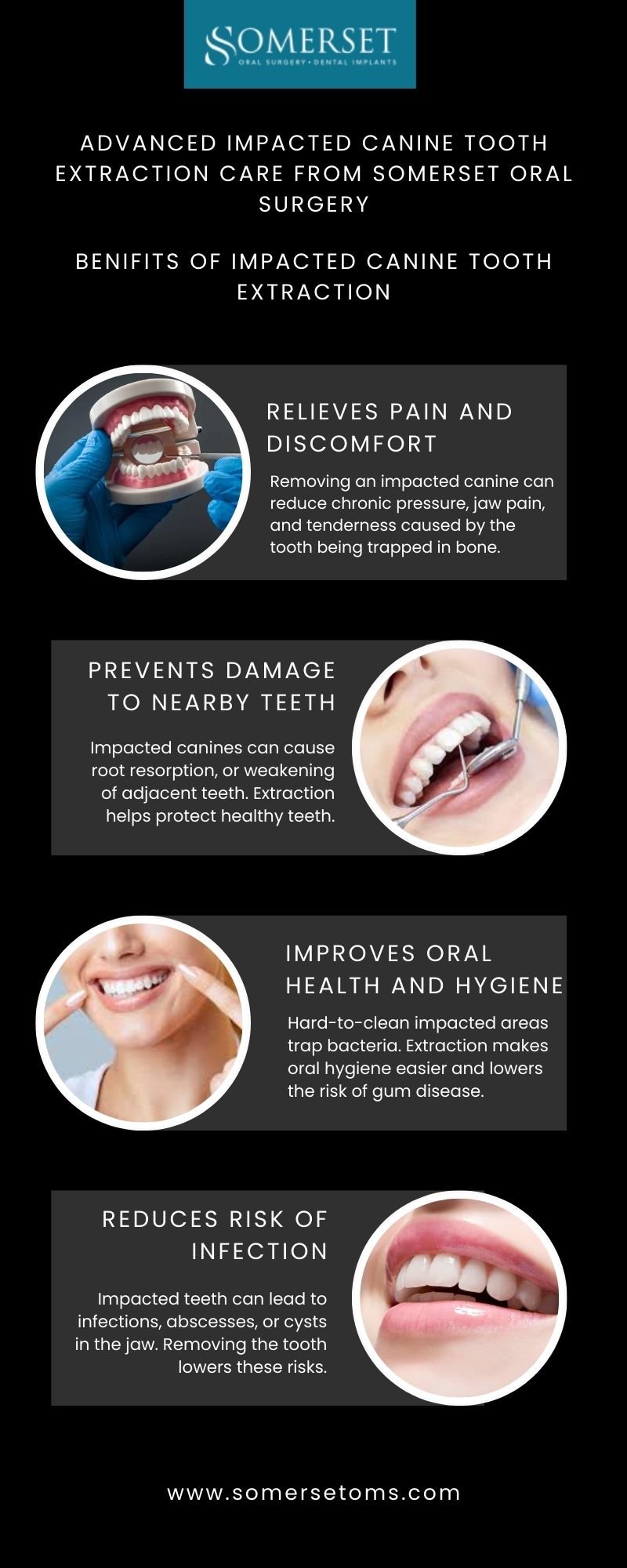 Advanced impacted canine tooth extraction care from Somerset Oral Surgery