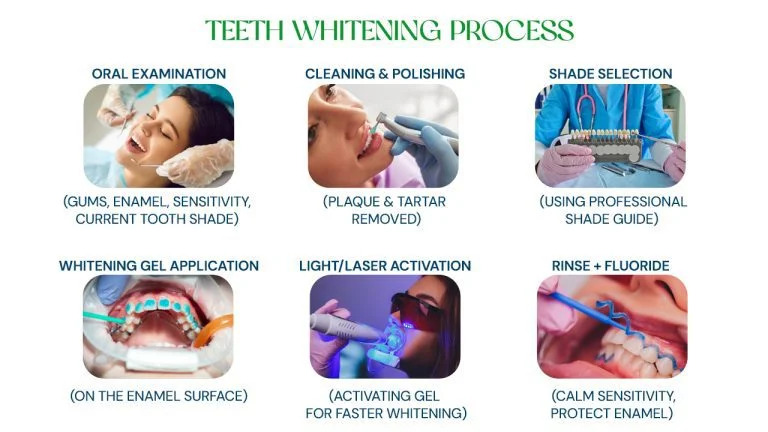 Teeth Whitening in Hyderabad | Step-by-Step Professional Process – Asian Dental