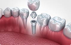 Smile First Dental Clinic: Affordable, Advanced, and Patient-Focused Dental Care in Abu Dhabi