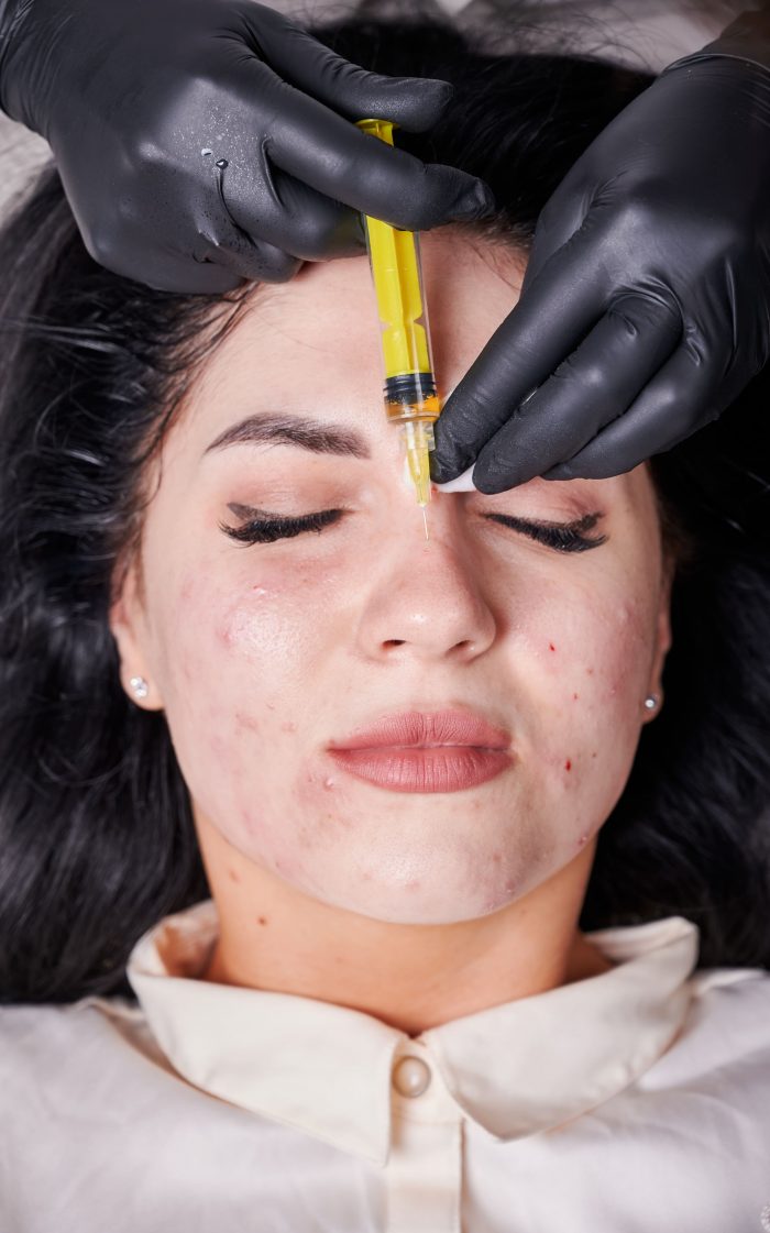 THIO Connects You with the Best Doctor for Pigmentation in Delhi