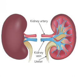 Kidney Transplant Surgery Cost in India – Hospisity
