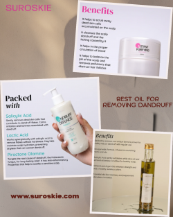 Best Oil For Removing Dandruff | Suroskie