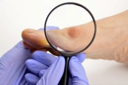 Expert Treatment for Hammer Toe, Heel Bumps & Bunions for Lasting Foot Pain Relief