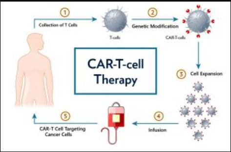 CAR T-Cell Therapy Cost in India – HOSPISITY
