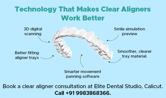 Advanced Technology Behind Clear Aligners for Better Smile Results