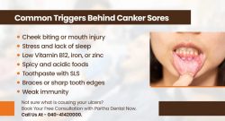 Common Causes of Canker Sores