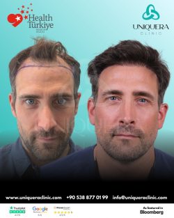 DHI Hair Replacement – Uniquera Clinic Turkey