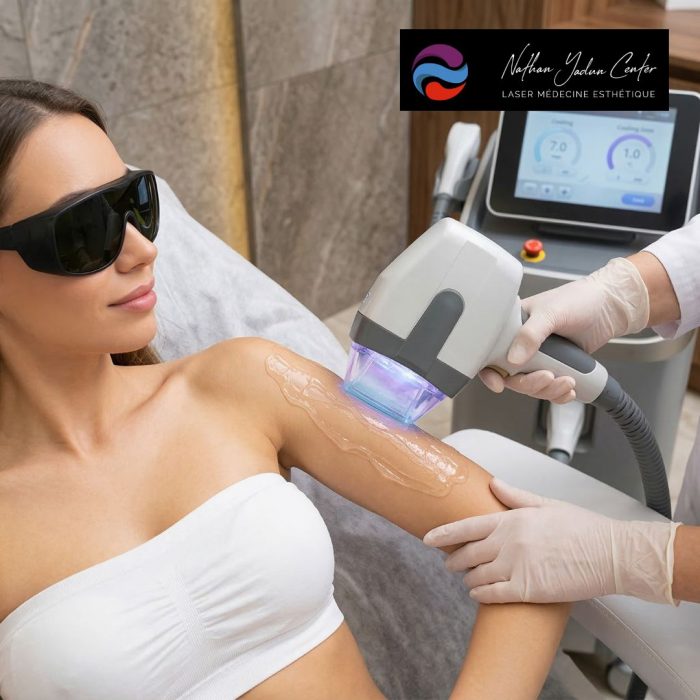 Laser Épilation Définitive : Comment Fonctionne Cette Solution ?