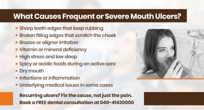 Mouth Ulcer Causes & Treatment | Partha Dental Hospital in Hyderabad