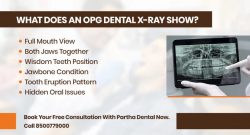 Benefits of OPG Dental X-Ray | Best Dental Clinic in Hyderabad Guide
