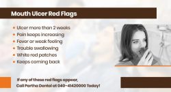 Mouth Ulcer Red Flags You Should Never Ignore