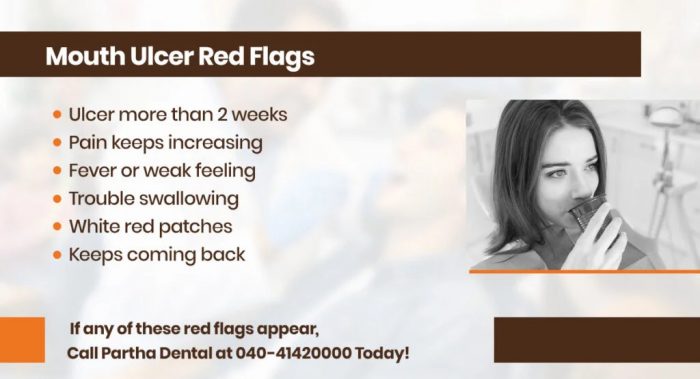 Mouth Ulcer Red Flags You Should Never Ignore